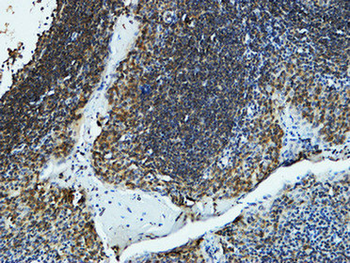CYP19A1 Polyclonal Antibody