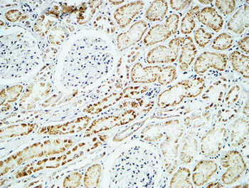 Crystallin-αB Polyclonal Antibody