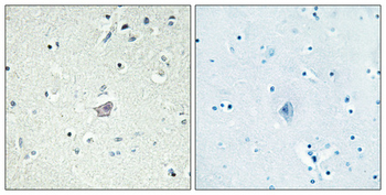 CRF-RII Polyclonal Antibody