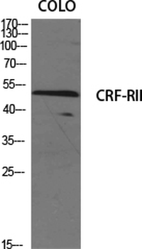 CRF-RII Polyclonal Antibody