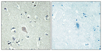 CRF-RI Polyclonal Antibody