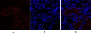 Cox-2 Polyclonal Antibody