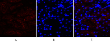 Cox-2 Polyclonal Antibody