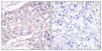 COT Polyclonal Antibody