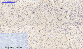 Connexin 43 Polyclonal Antibody