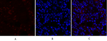 COL2A1 Polyclonal Antibody