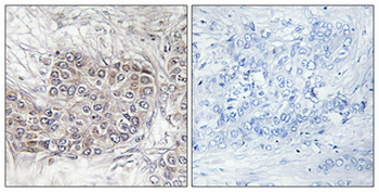 CNK1 Polyclonal Antibody