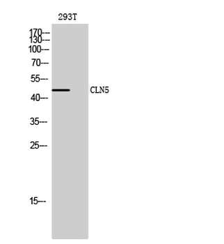 CLN5 Polyclonal Antibody