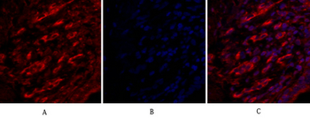 Claudin-5 Polyclonal Antibody