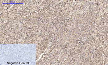 Claudin-5 Polyclonal Antibody
