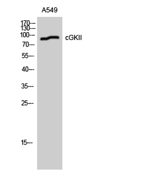 cGKII Polyclonal Antibody