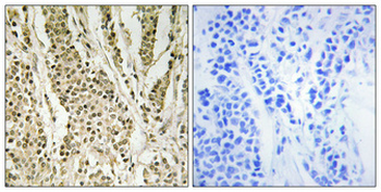 Cerebral 1 Polyclonal Antibody