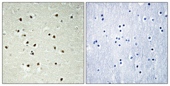 CEP70 Polyclonal Antibody