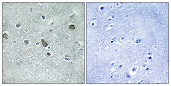 Cdc42EP5 Polyclonal Antibody