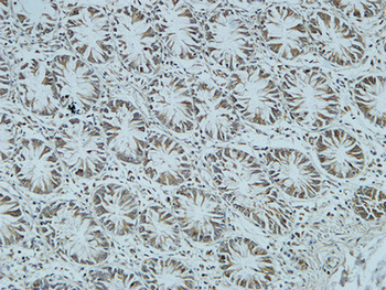 Cdc25B Polyclonal Antibody