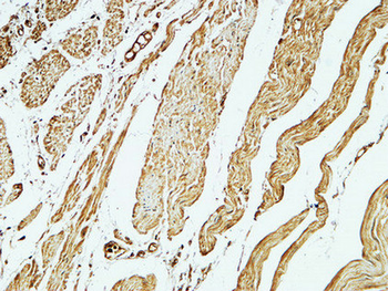 CD79a Polyclonal Antibody