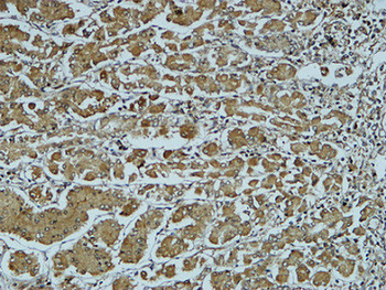 Cathepsin B Polyclonal Antibody