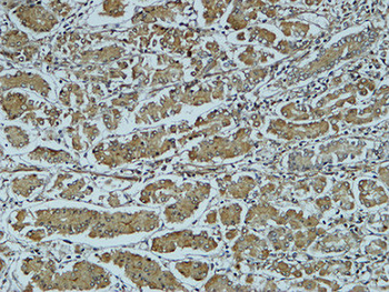 Cathepsin B Polyclonal Antibody