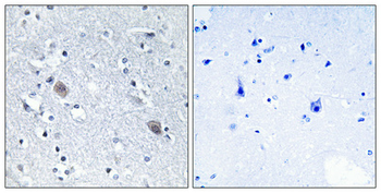 Calponin 2 Polyclonal Antibody