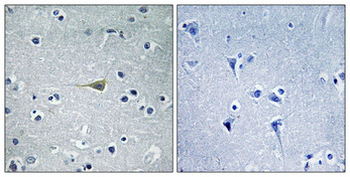 CA VB Polyclonal Antibody