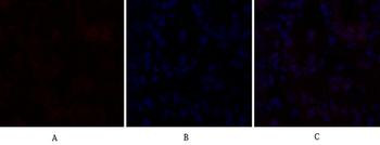 C/EBP β Polyclonal Antibody