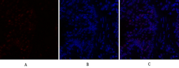 C/EBP β Polyclonal Antibody