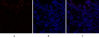 C/EBP β Polyclonal Antibody