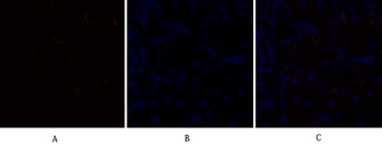 C/EBP β Polyclonal Antibody
