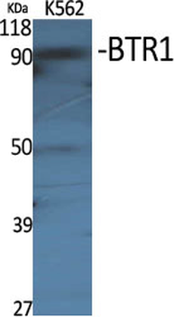 BTR1 Polyclonal Antibody