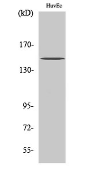 BRCAA1 Polyclonal Antibody