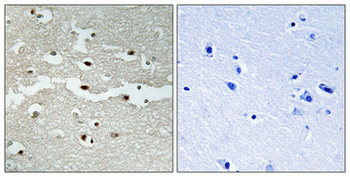 BRCA2 Polyclonal Antibody