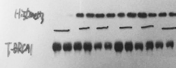 BRCA1 Polyclonal Antibody