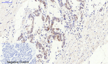 Bcl-2 Polyclonal Antibody