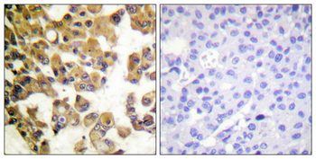 Bad Polyclonal Antibody