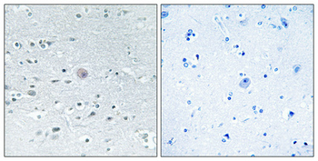 Arylsulfatase F Polyclonal Antibody