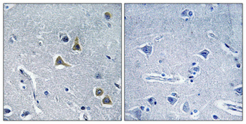 ARRDC2 Polyclonal Antibody