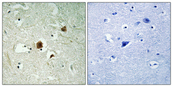 ARHGAP22 Polyclonal Antibody