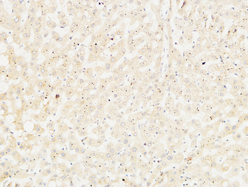 Arginase I Polyclonal Antibody