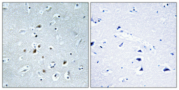 AP-2γ Polyclonal Antibody