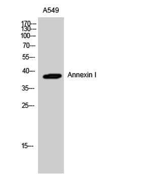 Annexin I Polyclonal Antibody