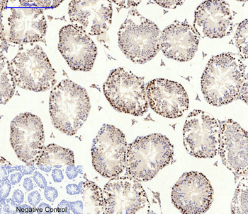 AMPKα1/2 Polyclonal Antibody