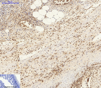 AMPKα1/2 Polyclonal Antibody