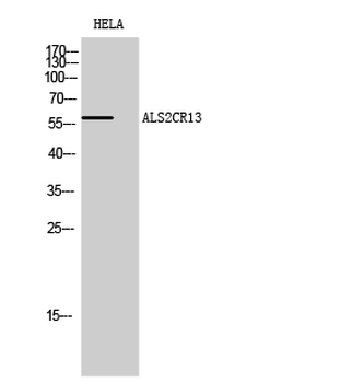 ALS2CR13 Polyclonal Antibody