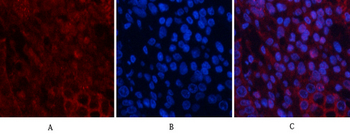 Akt Polyclonal Antibody