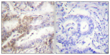 Akt1 Polyclonal Antibody