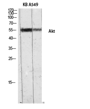 Akt Polyclonal Antibody