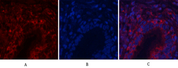 Akt1 Polyclonal Antibody