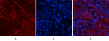 Akt1 Polyclonal Antibody
