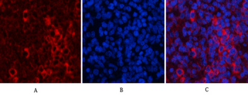 Akt1 Polyclonal Antibody