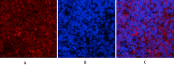Akt1 Polyclonal Antibody